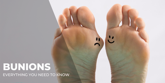 Everything You Need to Know About Bunions (and What You Probably Didn’t Know)